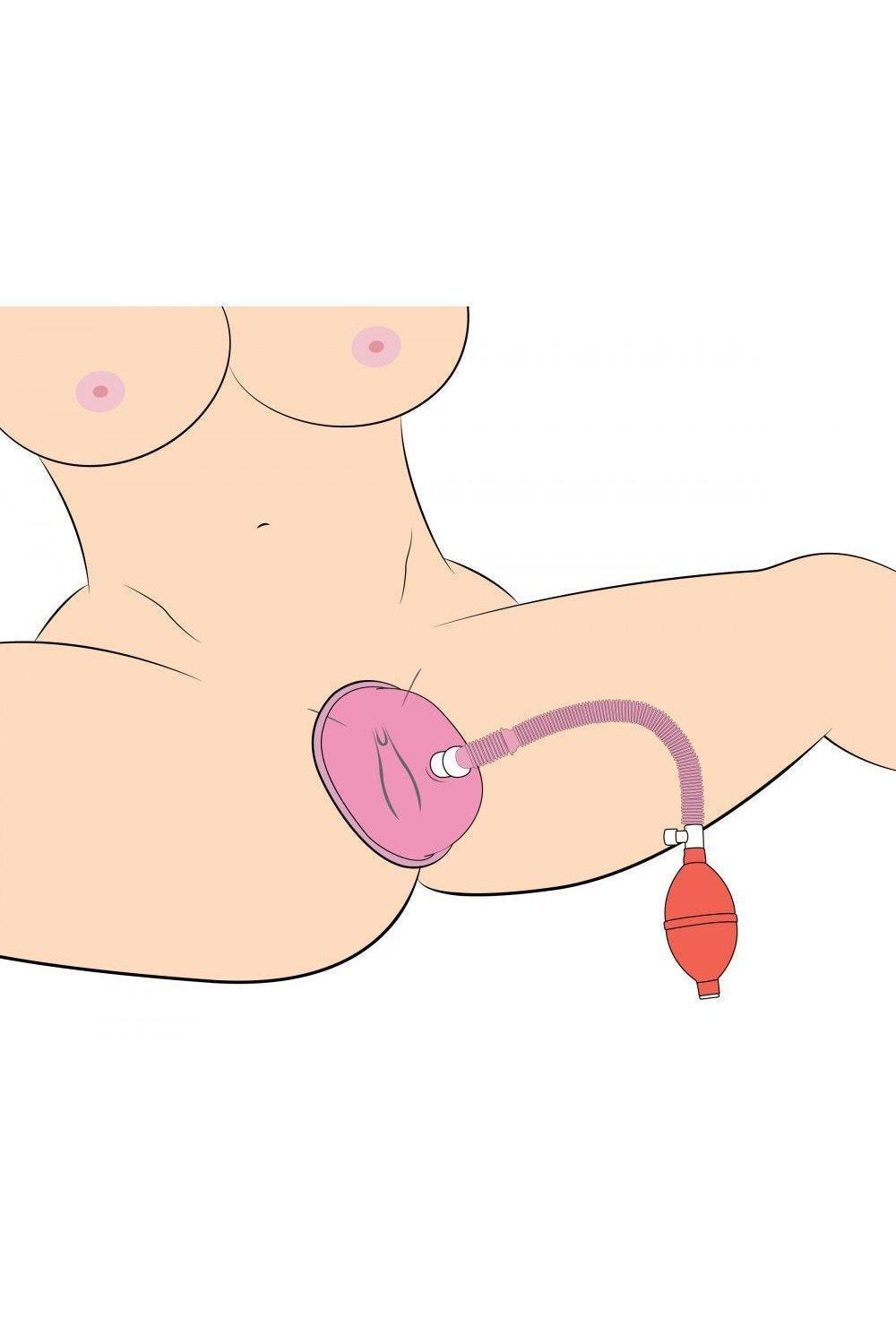 Vaginal Pump with 5 Inch Large Cup - Sex On the Go